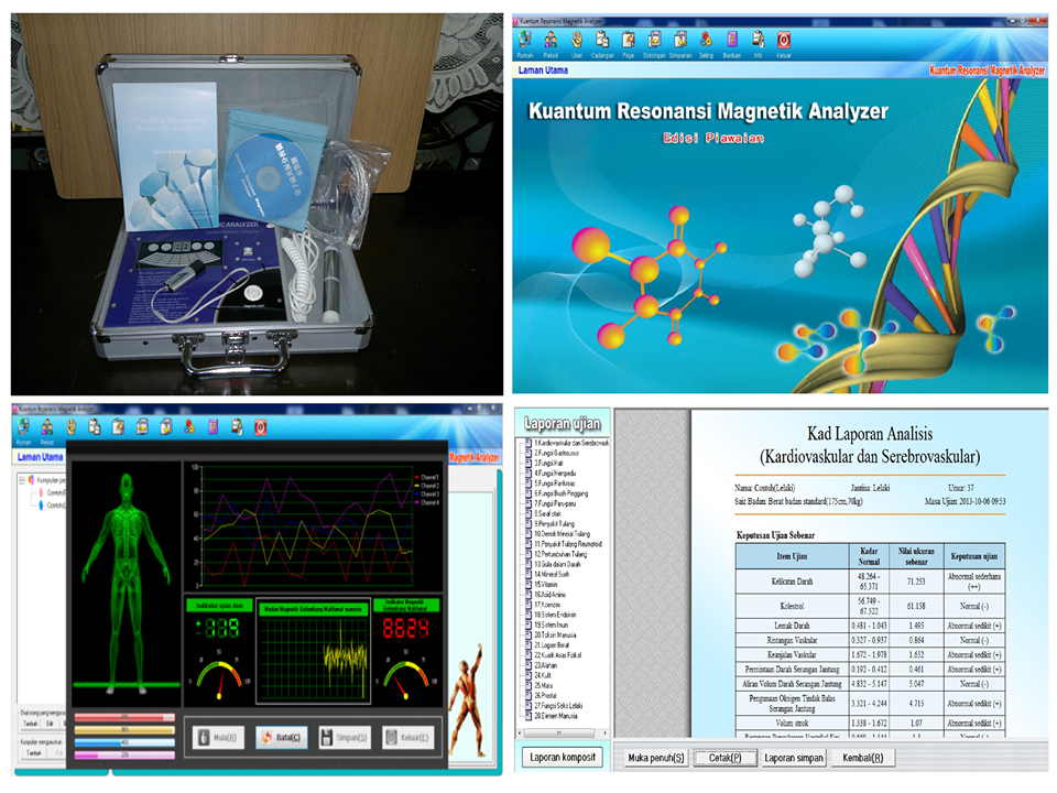 Quantum Resonance Magnetic Analyzer (QRMA) - Image 8