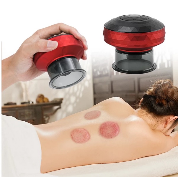 Cup Bekam Elektrik (Smart Electric Cupping Massage) - Image 6