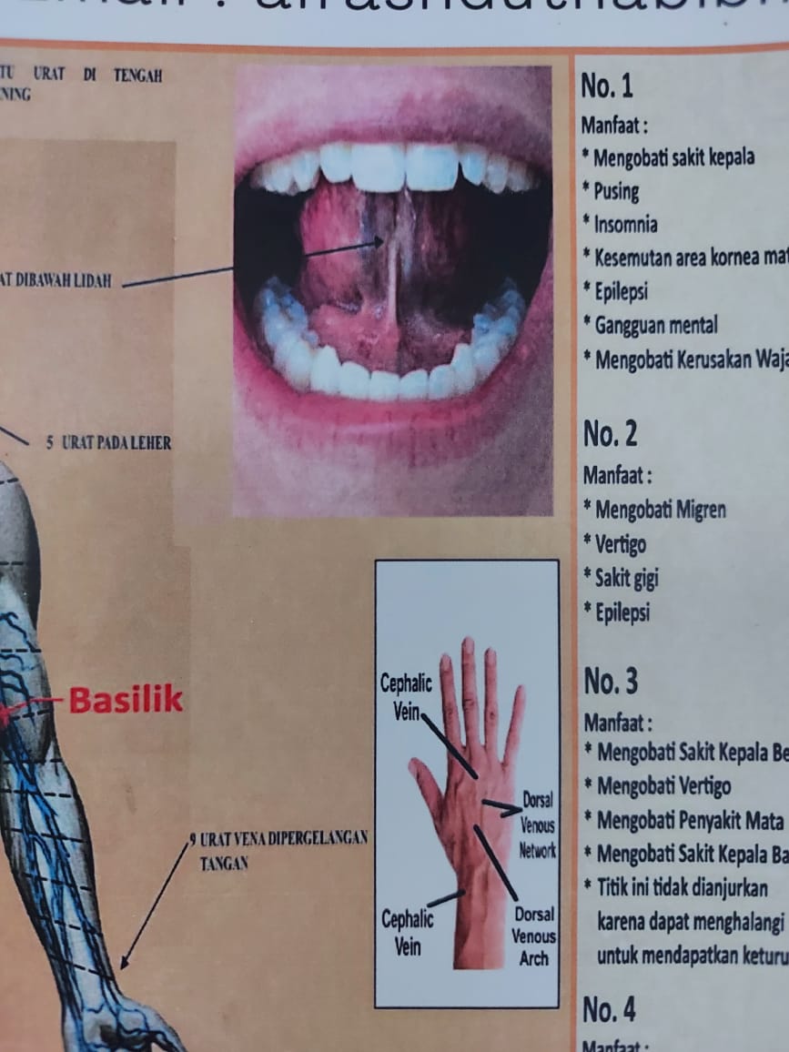 Poster Fashdu Venipuncture - Image 4