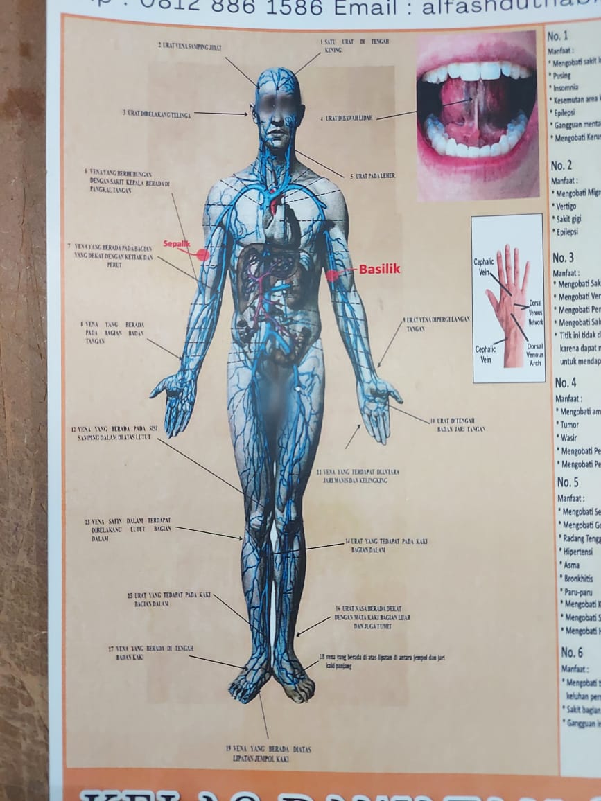Poster Fashdu Venipuncture - Image 7
