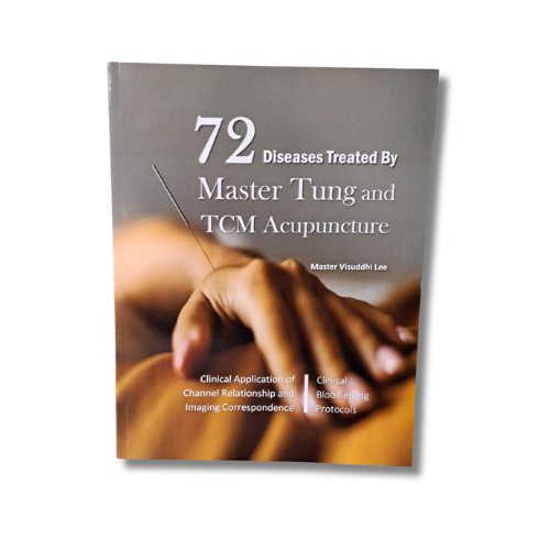 Buku 72 Diseases Treated By Master Tung and TCM Acupuncture (Versi1)